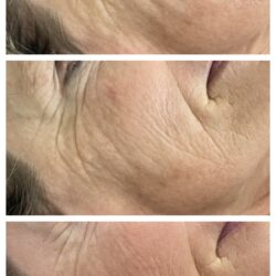 301F18B7-0A9B-47B7-9298-F859BB99B9E0-COLLAGE