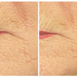 EAA52E53-A71C-48BB-A6EF-8463DF9784D9-COLLAGE